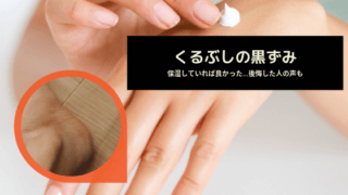 股ずれのせいでヒドイ黒ずみが 出来たり治ったりを繰り返すと悲劇に Masirog ましろぐ